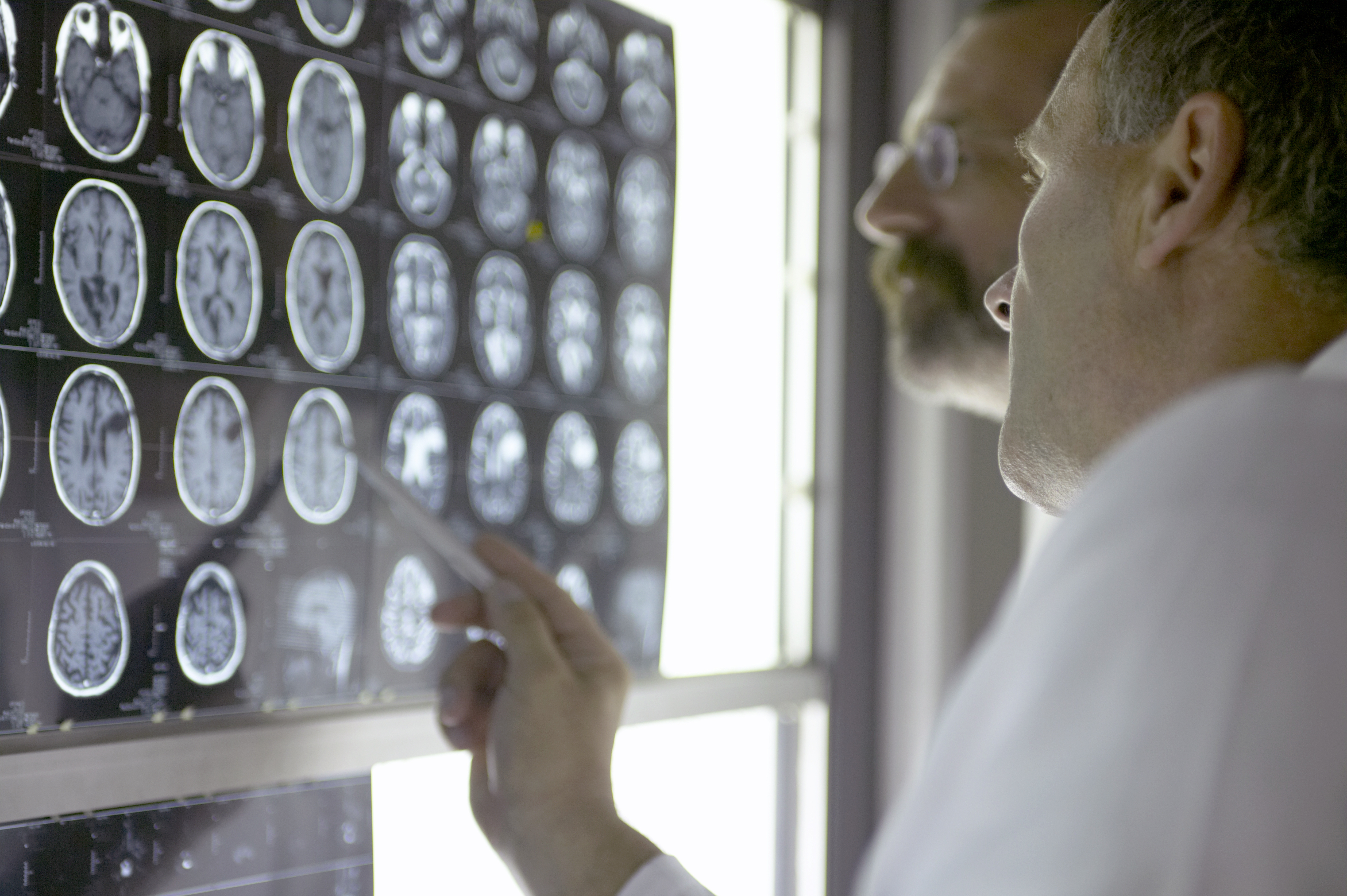 Consultation with Neurologist