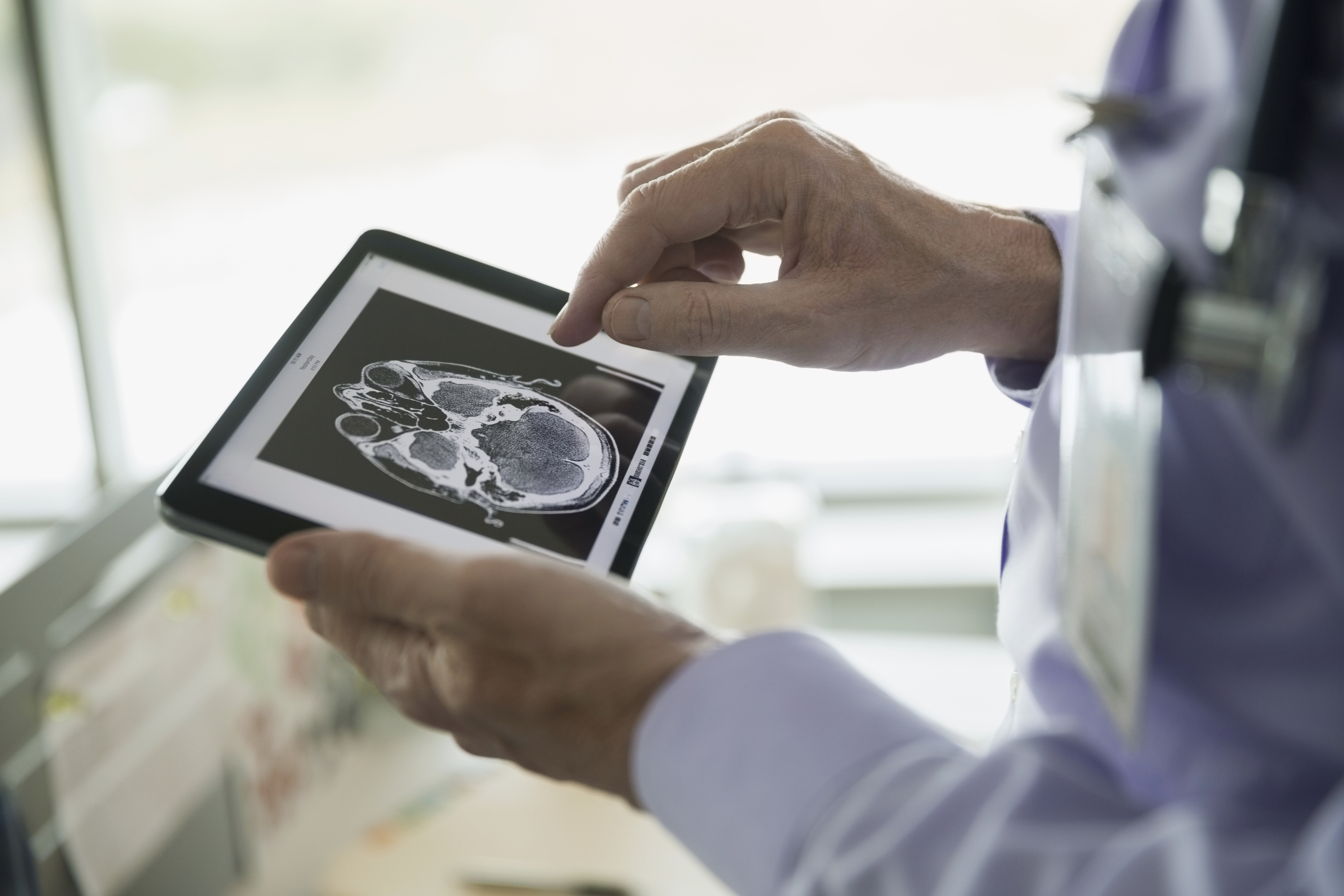 Sonography